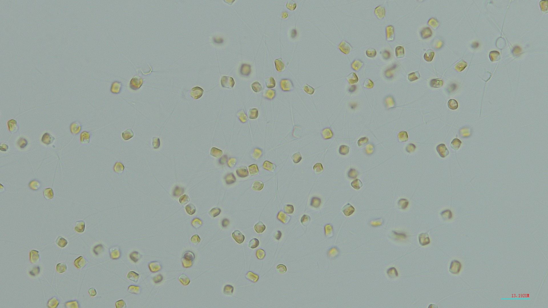 圖三、牟氏角毛藻 (400x)