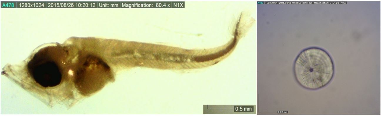 圖1、本所於臺灣東部海域採集之太平洋黑鮪仔魚 (體長5.34 mm) 及其耳石.JPG