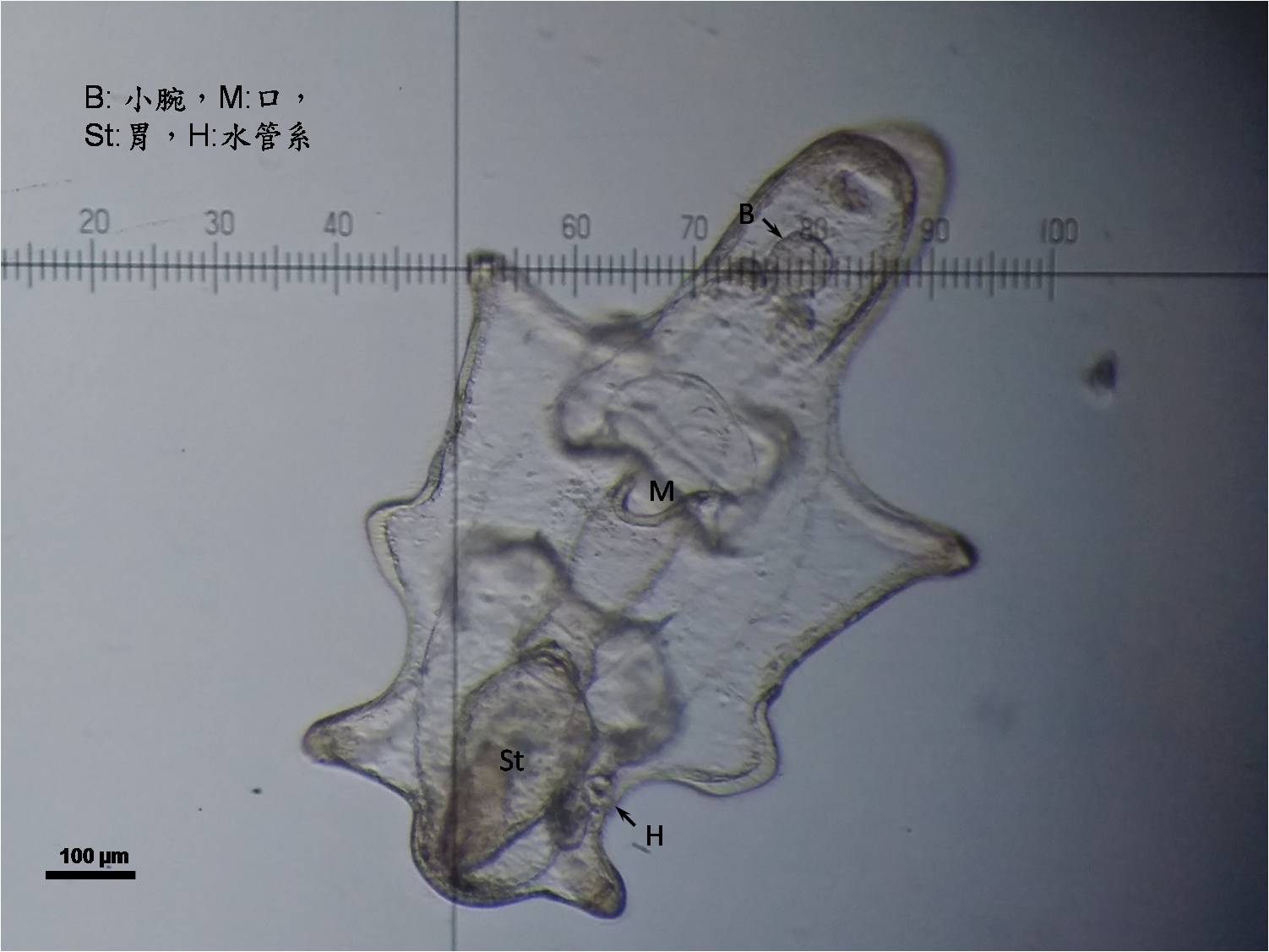 飛白楓海星小腕幼生