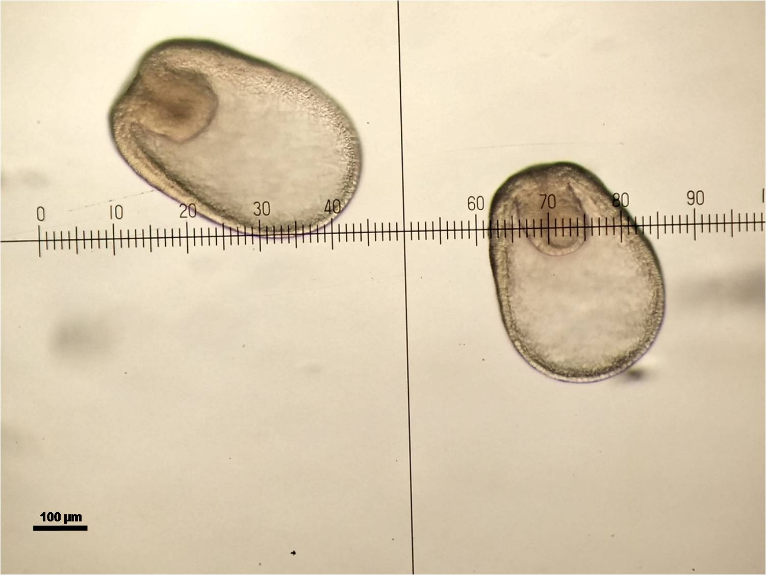 飛白楓海星原腸胚