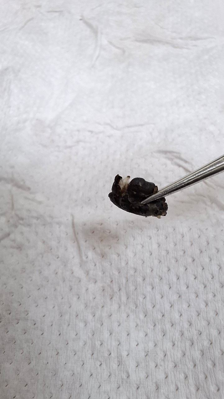 照片確認