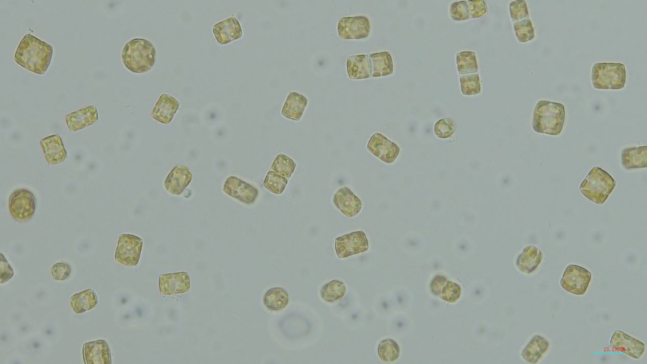 圖一、魏氏海鏈藻 (400x)