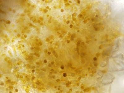 圖4、某些有孔蟲內部有共生性藻類