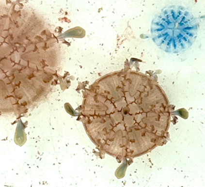 圖3、具有典型傘狀結構的蝶狀體